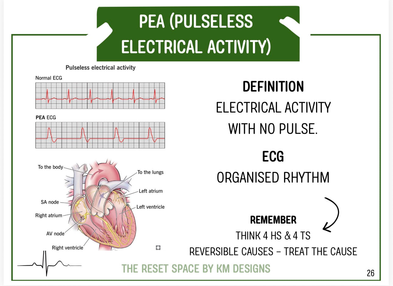 ECG Pocket Guide (A6) – Student Paramedic ECG Interpretation Download | Digital Download Format