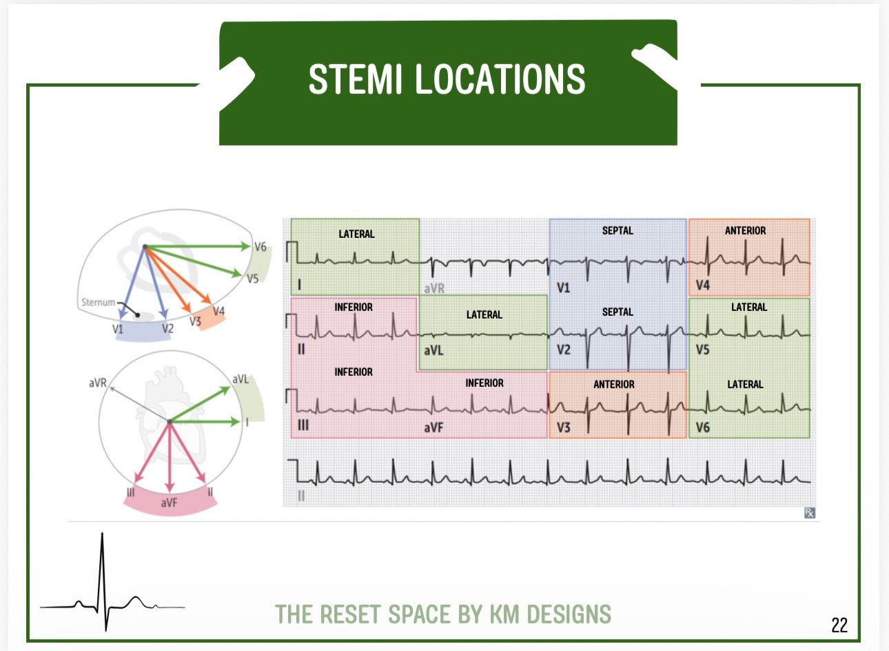 ECG Pocket Guide (A6) – Student Paramedic ECG Interpretation Download | Digital Download Format