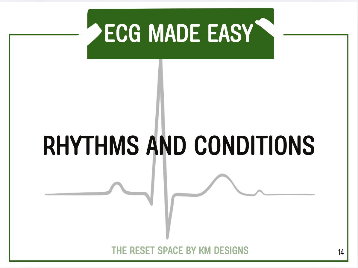 ECG Pocket Guide (A6) – Student Paramedic ECG Interpretation Download | Digital Download Format