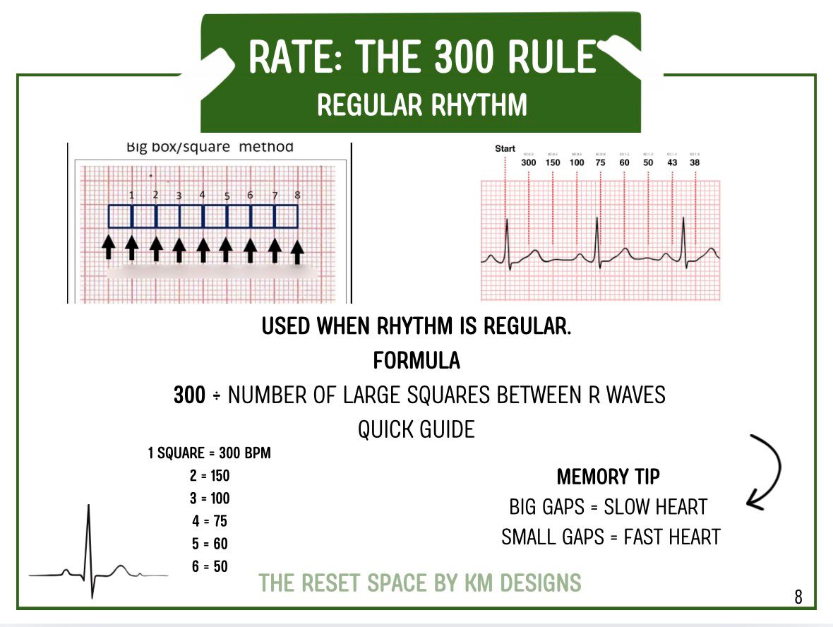 ECG Pocket Guide (A6) – Student Paramedic ECG Interpretation Download | Digital Download Format